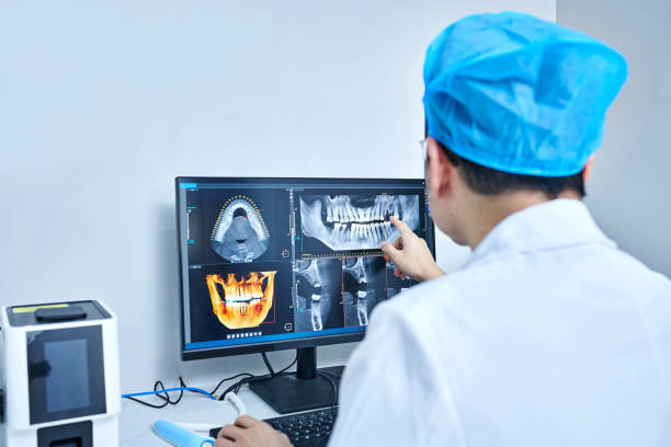 Best Emergency Tooth Extraction in Diamond Springs, CA