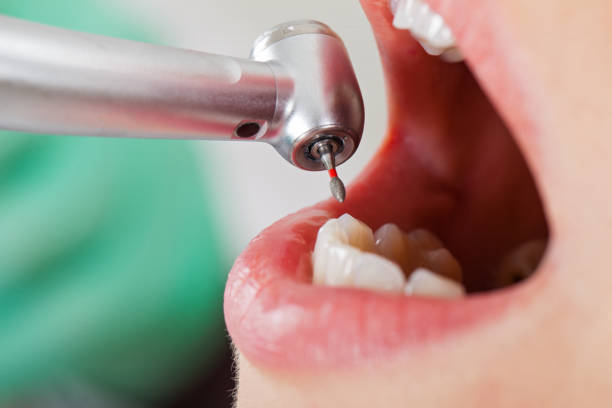 Best Emergency Denture Repair in Diamond Springs, CA